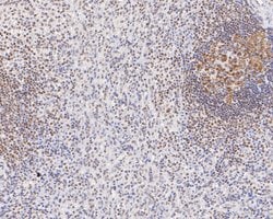 Invitrogen GTF2I Recombinant Rabbit Monoclonal Antibody (JE56-20) 100 &mu;L;