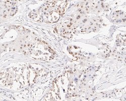 Invitrogen GTF2I Recombinant Rabbit Monoclonal Antibody (JE56-20) 100 &mu;L;