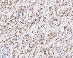 Invitrogen GTF2I Recombinant Rabbit Monoclonal Antibody (JE56-20) 100 &mu;L;