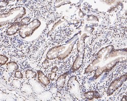 Invitrogen GTF2I Recombinant Rabbit Monoclonal Antibody (JE56-20) 100 &mu;L;