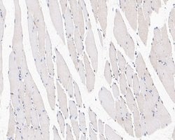 Invitrogen UBE4B Recombinant Rabbit Monoclonal Antibody (JE55-76) 100 &mu;L;
