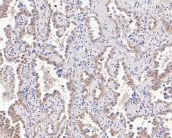 Invitrogen UBE4B Recombinant Rabbit Monoclonal Antibody (JE55-76) 100 &mu;L;