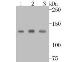 Invitrogen UBE4B Recombinant Rabbit Monoclonal Antibody (JE55-76) 100 &mu;L;