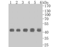Invitrogen PGD Recombinant Rabbit Monoclonal Antibody (JE56-26) 100 &mu;L | Buy Online | Invitrogen&trade; | Fisher Scientific