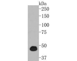 Invitrogen PGD Recombinant Rabbit Monoclonal Antibody (JE56-26) 100 &mu;L | Buy Online | Invitrogen&trade; | Fisher Scientific