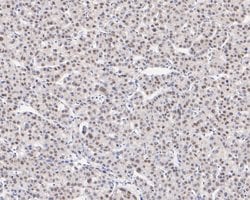Invitrogen TRMT2A Recombinant Rabbit Monoclonal Antibody (JE55-60) 100