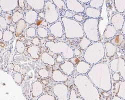 Invitrogen TRMT2A Recombinant Rabbit Monoclonal Antibody (JE55-60) 100