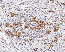 Invitrogen TRMT2A Recombinant Rabbit Monoclonal Antibody (JE55-60) 100