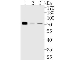 Invitrogen TRMT2A Recombinant Rabbit Monoclonal Antibody (JE55-60) 100