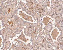 Invitrogen CARS Recombinant Rabbit Monoclonal Antibody (JE55-84) 100 &mu;L;