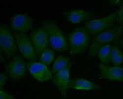 Invitrogen FADS1 Recombinant Rabbit Monoclonal Antibody (JE55-63) 100 &mu;L;