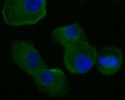 Invitrogen FADS1 Recombinant Rabbit Monoclonal Antibody (JE55-63) 100 &mu;L;