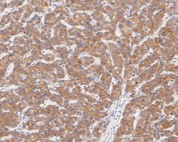 Invitrogen FADS1 Recombinant Rabbit Monoclonal Antibody (JE55-63) 100 &mu;L;