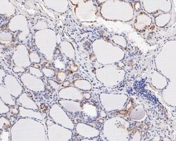 Invitrogen FADS1 Recombinant Rabbit Monoclonal Antibody (JE55-63) 100 &mu;L;