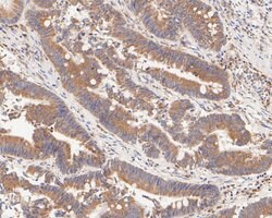 Invitrogen FADS1 Recombinant Rabbit Monoclonal Antibody (JE55-63) 100 &mu;L;