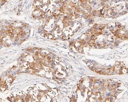 Invitrogen FADS1 Recombinant Rabbit Monoclonal Antibody (JE55-63) 100 &mu;L;