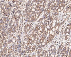 Invitrogen FADS1 Recombinant Rabbit Monoclonal Antibody (JE55-63) 100 &mu;L;