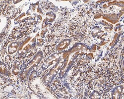 Invitrogen FADS1 Recombinant Rabbit Monoclonal Antibody (JE55-63) 100 &mu;L;