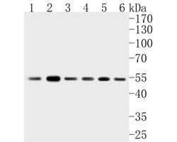 Invitrogen FADS1 Recombinant Rabbit Monoclonal Antibody (JE55-63) 100 &mu;L;