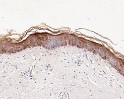 Invitrogen SERPINB3 Recombinant Rabbit Monoclonal Antibody (JE55-93) 100