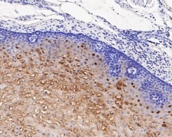 Invitrogen SERPINB3 Recombinant Rabbit Monoclonal Antibody (JE55-93) 100