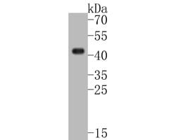 Invitrogen SERPINB3 Recombinant Rabbit Monoclonal Antibody (JE55-93) 100