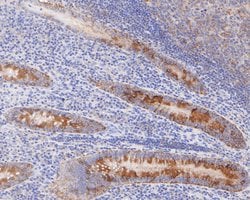 Invitrogen CC2D1A Recombinant Rabbit Monoclonal Antibody (JE55-34) 100 &mu;L | Buy Online | Invitrogen&trade; | Fisher Scientific