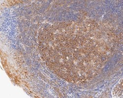 Invitrogen CC2D1A Recombinant Rabbit Monoclonal Antibody (JE55-34) 100 &mu;L | Buy Online | Invitrogen&trade; | Fisher Scientific