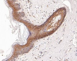 Invitrogen Desmocollin 3 Recombinant Rabbit Monoclonal Antibody (JE55-86)