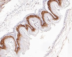 Invitrogen Desmocollin 3 Recombinant Rabbit Monoclonal Antibody (JE55-86)