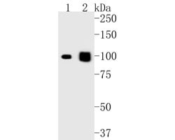 Invitrogen Desmocollin 3 Recombinant Rabbit Monoclonal Antibody (JE55-86)