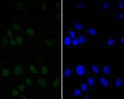 Invitrogen CtBP2 Recombinant Rabbit Monoclonal Antibody (JE56-00) 100 &mu;L;