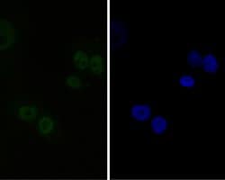 Invitrogen CtBP2 Recombinant Rabbit Monoclonal Antibody (JE56-00) 100 &mu;L;