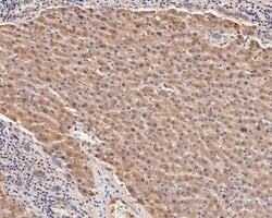 Invitrogen PIM2 Recombinant Rabbit Monoclonal Antibody (JE55-57) 100 &mu;L;