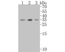 Invitrogen PIM2 Recombinant Rabbit Monoclonal Antibody (JE55-57) 100 &mu;L;