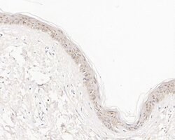 Invitrogen ABH1 Recombinant Rabbit Monoclonal Antibody (JE56-09) 100 &mu;L;