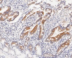 Invitrogen ABH1 Recombinant Rabbit Monoclonal Antibody (JE56-09) 100 &mu;L;