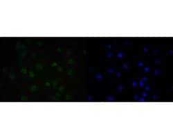 Invitrogen QKI Recombinant Rabbit Monoclonal Antibody (JE55-71) 100 &mu;L | Buy Online | Invitrogen&trade; | Fisher Scientific