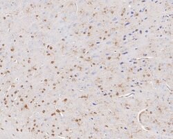 Invitrogen QKI Recombinant Rabbit Monoclonal Antibody (JE55-71) 100 &mu;L | Buy Online | Invitrogen&trade; | Fisher Scientific