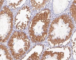 Invitrogen CLGN Recombinant Rabbit Monoclonal Antibody (JE58-25) 100 μL;