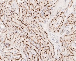 Invitrogen EGR1 Recombinant Rabbit Monoclonal Antibody (JE57-62) 100 &mu;L | Buy Online | Invitrogen&trade; | Fisher Scientific