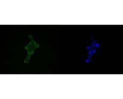 Invitrogen HDGF Recombinant Rabbit Monoclonal Antibody (JE56-32) 100 &mu;L;