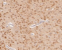 Invitrogen ACSL4 Recombinant Rabbit Monoclonal Antibody (JE56-33) 100 &mu;L;