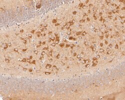 Invitrogen ACSL4 Recombinant Rabbit Monoclonal Antibody (JE56-33) 100 &mu;L;
