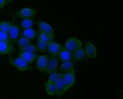 Invitrogen CD21 Monoclonal Antibody (A4E5) 100 &mu;L; Unconjugated:Antibodies,