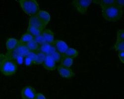 Invitrogen CD21 Monoclonal Antibody (A4E5) 100 &mu;L; Unconjugated:Antibodies,