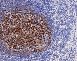Invitrogen CD21 Monoclonal Antibody (A4E5) 100 &mu;L; Unconjugated:Antibodies,