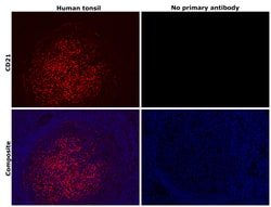 Invitrogen CD21 Monoclonal Antibody (A4E5) 100 &mu;L; Unconjugated:Antibodies,