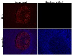 Invitrogen CD21 Monoclonal Antibody (A4E5) 100 &mu;L; Unconjugated:Antibodies,