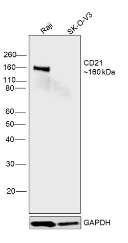 Invitrogen CD21 Monoclonal Antibody (A4E5) 100 &mu;L; Unconjugated:Antibodies,